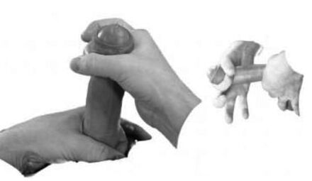 Esguince del pene para aumentarlo